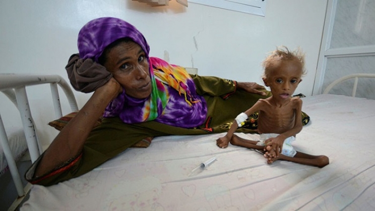Dječak Saleem iz Jemena je umirao od gladi, danas je jak i nasmijan dječak (VIDEO)