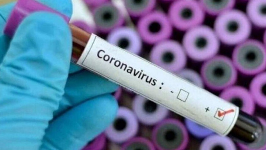 U Crnoj Gori tri nova slučaja koronavirusa, ukupno 13