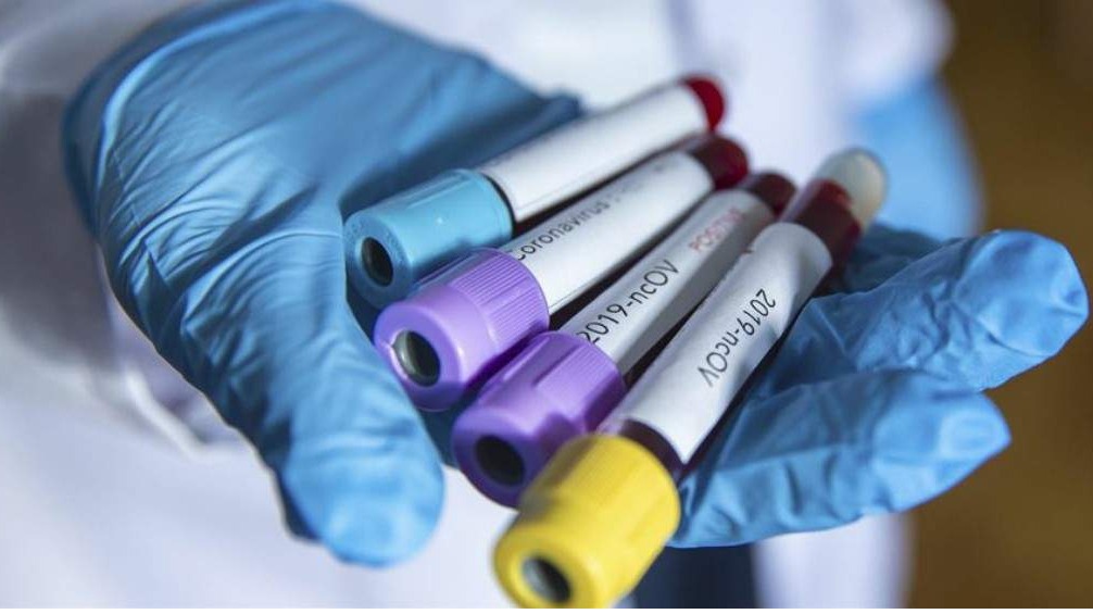 U Italiji od koronavirusa umrla još 651 osoba, ali u padu je trend rasta broja zaraženih
