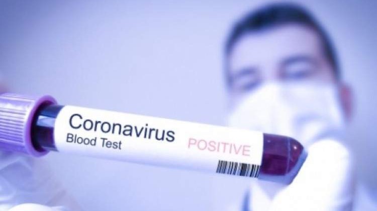 Pehar: U protekla 24 sata u FBiH testirane 553 osobe, 22 pozitivne na koronavirus