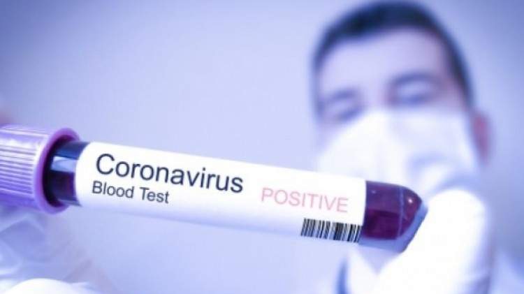 Broj zaraženih koronavirusom u svijetu premašio tri miliona