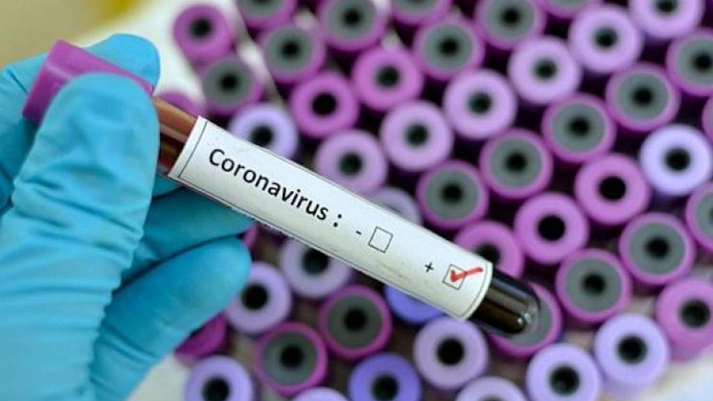 U FBiH 14 novih slučajeva koronavirusa, oporavljeno 949 pacijenata