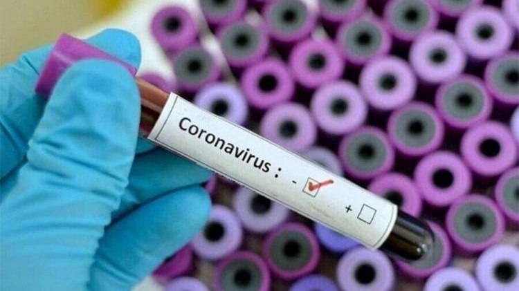 KS - U protekla 24 sata kod 35 osoba potvrđena zaraza koronavirusom