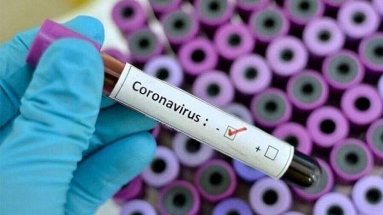 U FBiH 186 novozaraženih od 1.288 testiranih na koronavirus