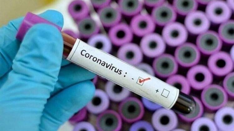 Koronavirusom u svijetu zaraženo više od 12 miliona ljudi