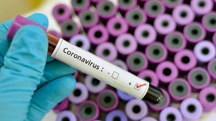U protekla 24 sata potvrđeno 213 novih slučajeva zaraze koronavirusom u KS