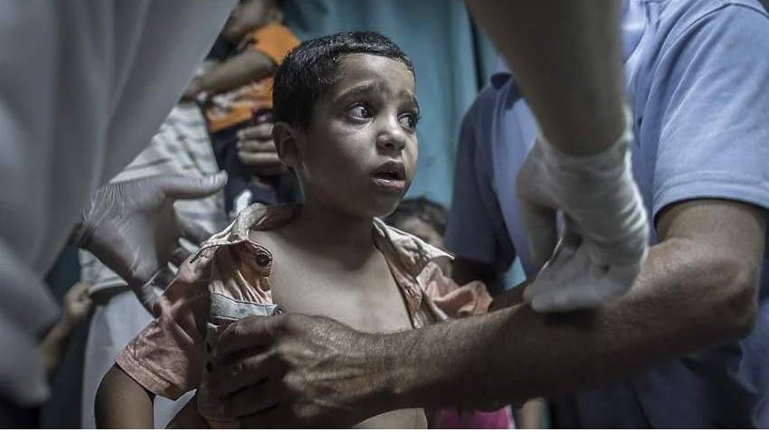 Palestinski doktor Hatem el-Hur upozorava: Bolnice u Gazi pune ljudi koji pate od pothranjenosti