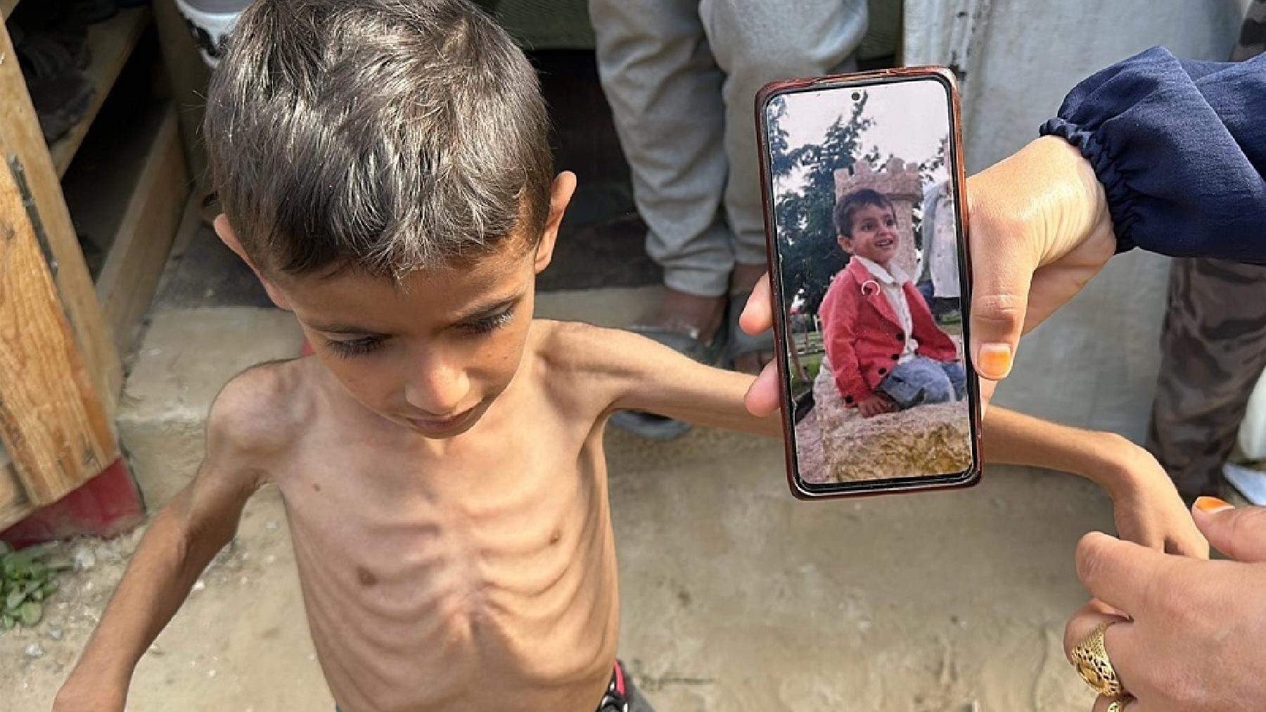 Još devetero Palestinaca, uključujući dvoje djece, umrlo od gladi u Gazi