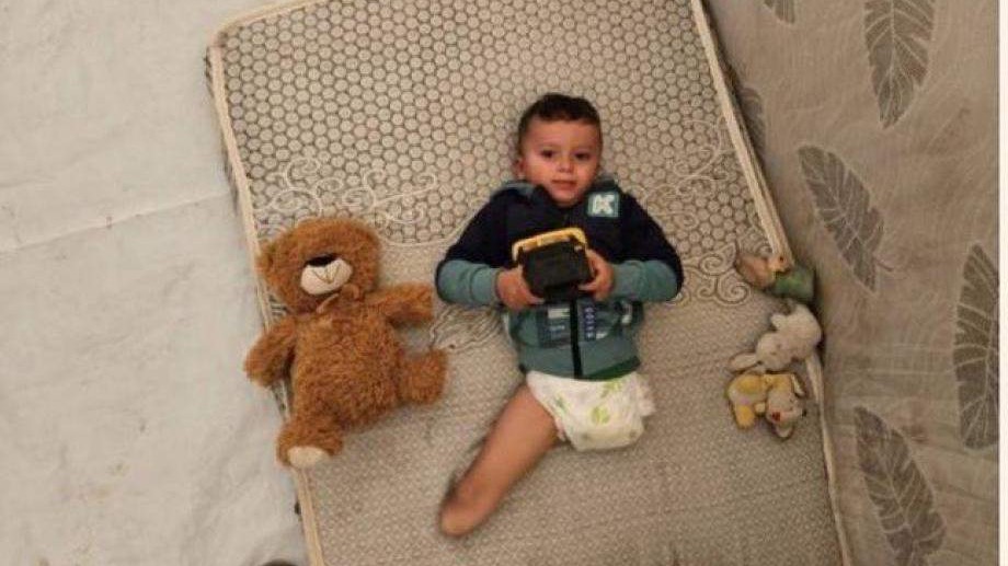 Od oktobra 2023. u Gazi urađeno 6.000 amputacija ekstremiteta