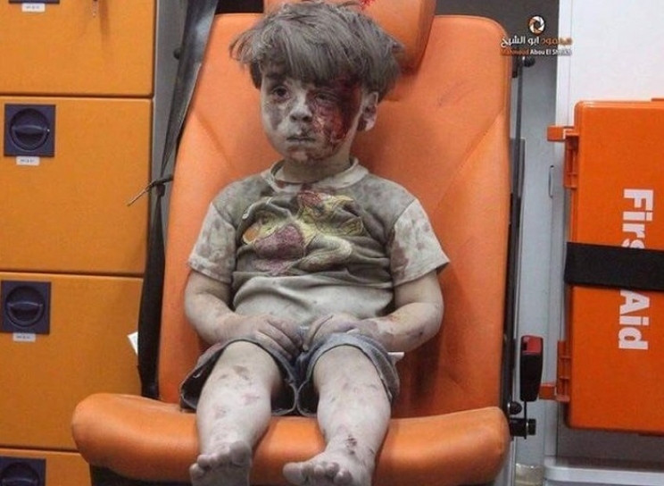 Petogodišnji dječak krvavog lica izvučen iz ruševina Alepa postao simbol rata