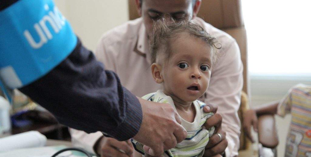 Yemen-1024x516.jpg - UNICEF upozorio na glad u Jemenu, zemlja 